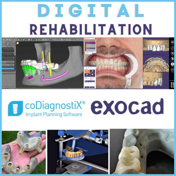 DENTAL DIGITAL REHABILITATION - CODIAGNOSTIX AND EXOCAD PROGRAMS
