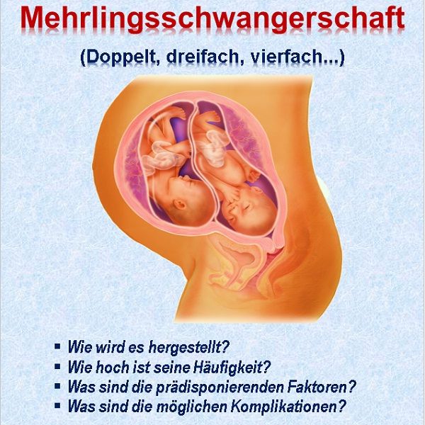 Mehrlingsschwangerschaft (Zwilling, Dreifach, Vierfach...)