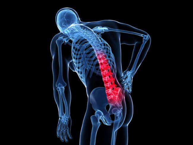 Leitfaden zur Behandlung von Rückenschmerzen im unteren Rückenbereich