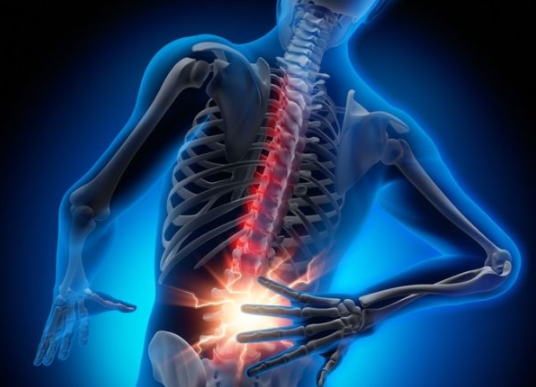 Rückenschmerzen auf natürliche Weise lindern