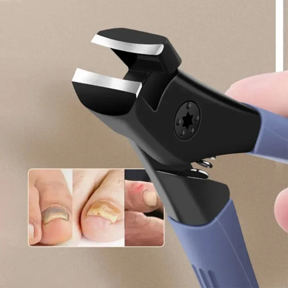 1 Piece Blue Nail Clipper, Suitable for Thick Nails, Ergonomic Handle, Foot Care Product, Effortless, Daily Essential