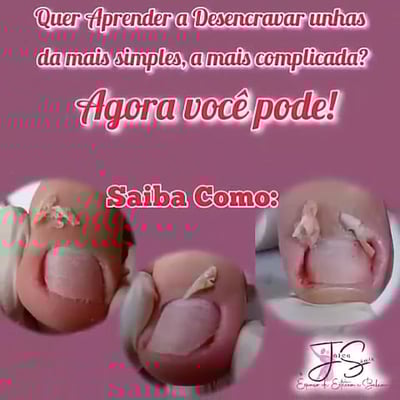 Curso de podologia valor