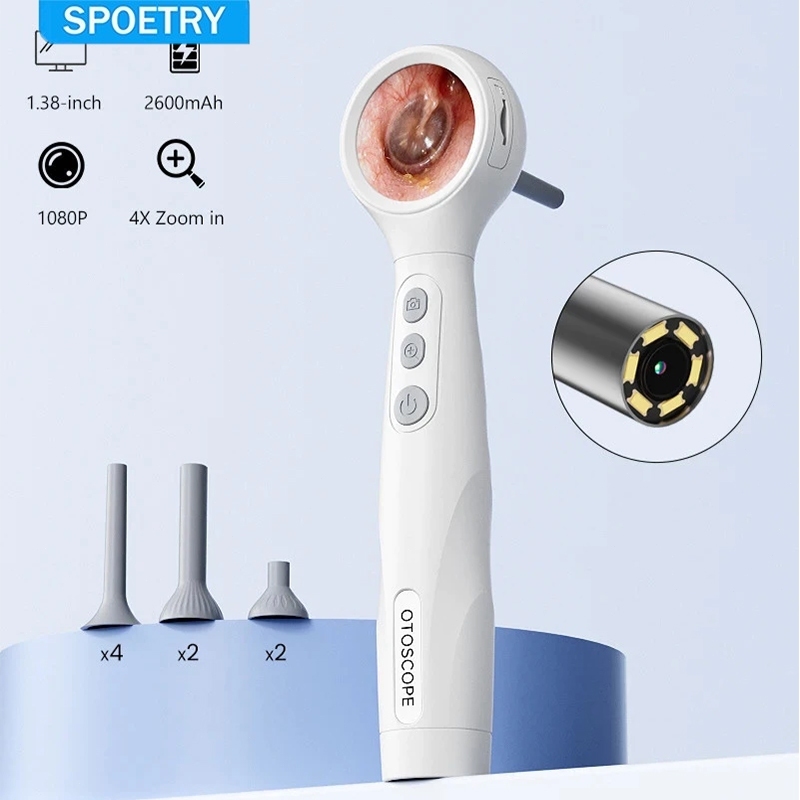 SPOETRY Otoscópio Digital Câmera Limpeza de Ouvido Tela IPS 1.38 HD 1080P 4.2mm Ultrafina Portátil