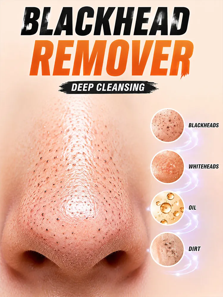 Rechargeable Blackhead Remover Facial Vacuum Cleaner with Adjustable Suction for Home Use