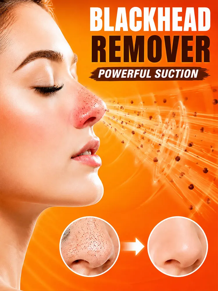 Smart Electric Blackhead Remover Facial Cleaner Rechargeable Pore Vacuum Tool for Deep Skin Cleansing Routine