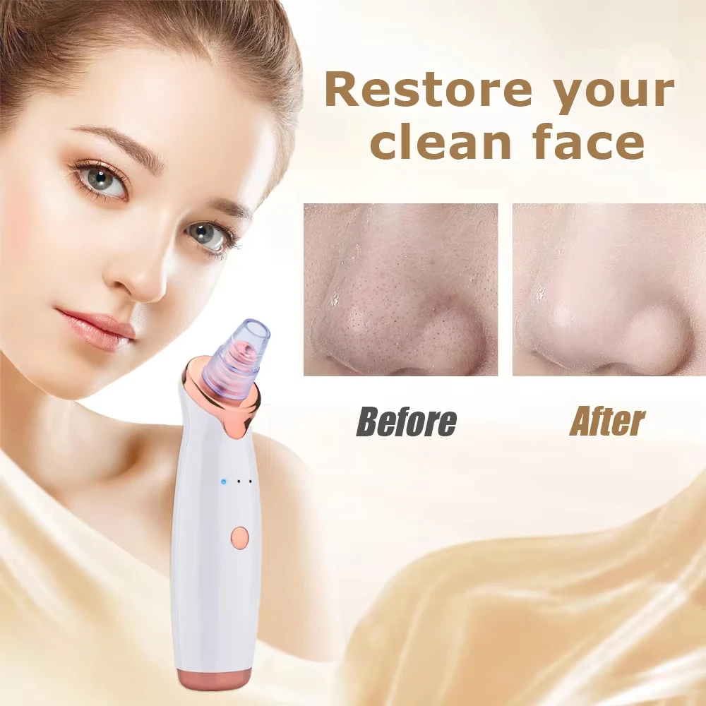 2026 New Electric Pore Cleaner & Blackhead Remover - Deep Cleansing Vacuum Device for Facial Care Face Skin Care Tools