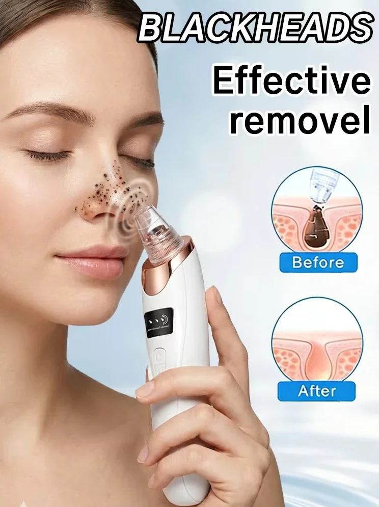 Blackhead Remover Pore Vacuum Facial Pore Cleaner-5 Suction Power 5 Probes USB Rechargeable Blackhead Vacuum