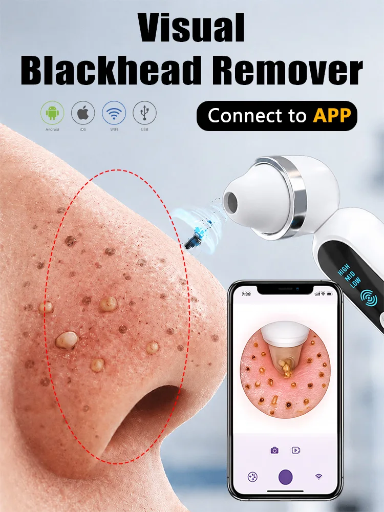 New Nose Blackhead Remover Pores Vacuum Pore Remover Blackheads and Pimple Suction With Camera