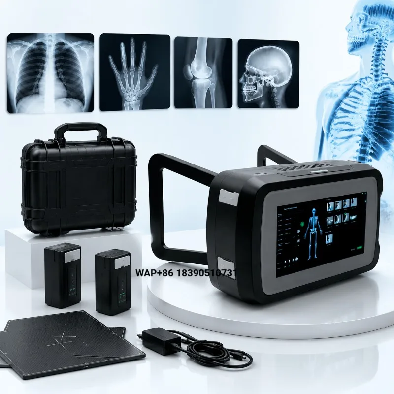 Digital X-ray machine, portable 90KV 5/10 Ma mobile X-ray device, mini portable X-ray machine for humans or veterinarians