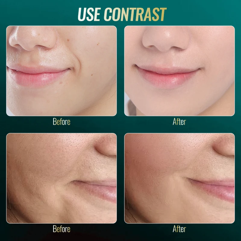 3-in-1 EMS Facial Device - Vibration Massage + Ice Cooling + Blue Light for Skin Tightening, Blemish Care & Pore Refining Lesen