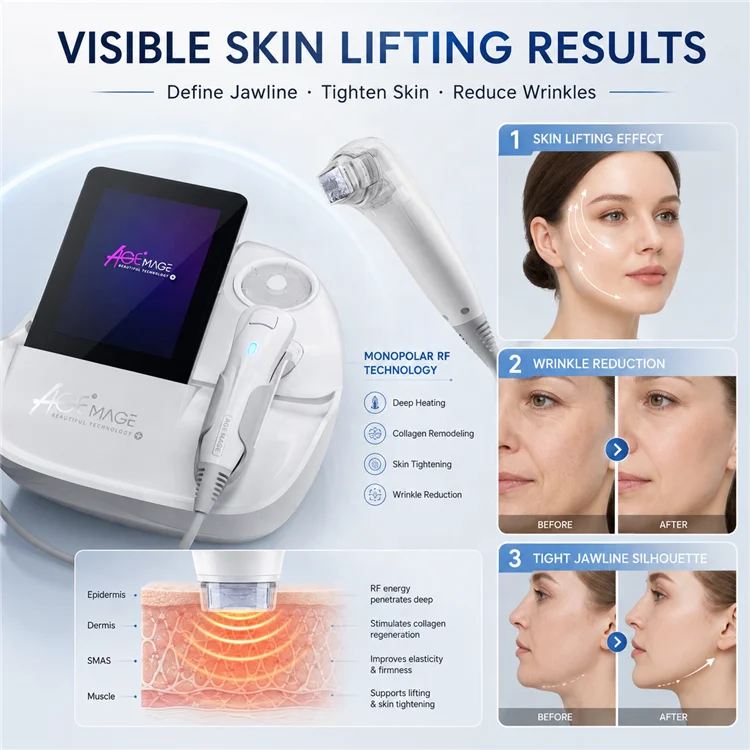Professional 6.78MHz Monopolar RF Skin Tightening Machine Face Lifting Wrinkle Removal Collagen Stimulation Device