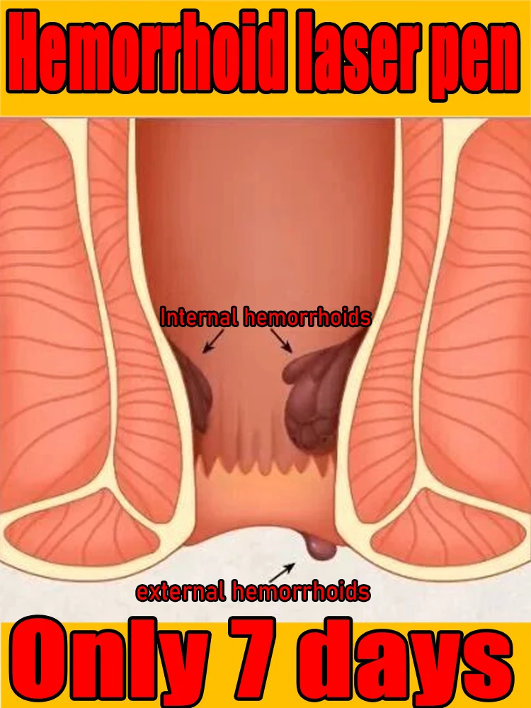 The second generation improves problems such as hemorrhoid leakage and can be used by both men and women.