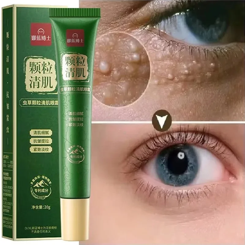 Fat Granules Remover Eye Cream Anti-Puffiness Anti Inflammatory Reduce Dark Circles Eyebags Fade Lines Moisturizing Eye Care