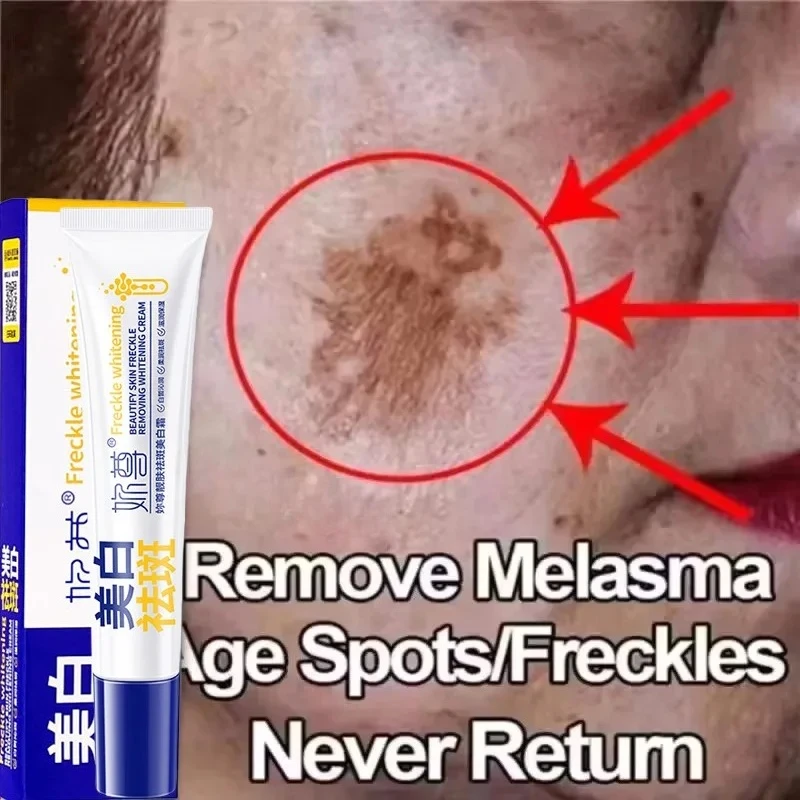 Powerful Spot-Removing Whiten Cream Brighten Skin Fast Eliminates Melanin Pigmentation Melasma Dark Spots Korean Face Skin Care