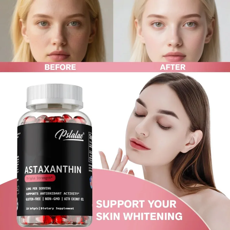 Astaxanthin - Good for The Heart and Brain, Powerful Antioxidant, Supports Joints, Muscle Health and Skin, Boosts Energy Levels