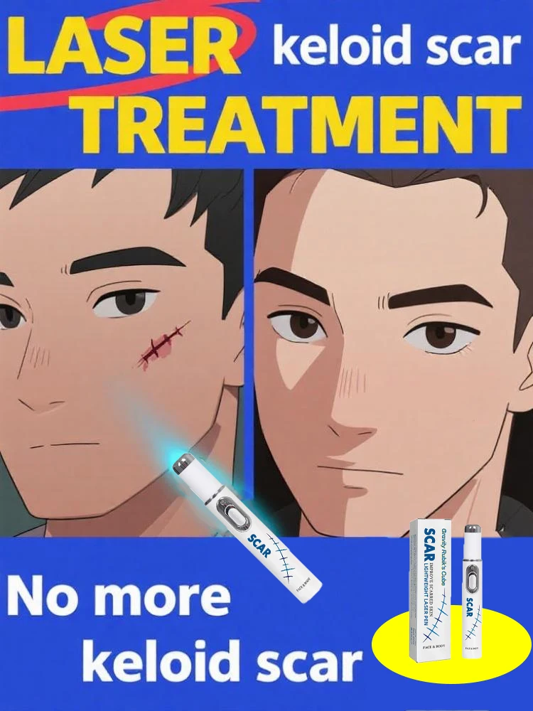 2 Generation Laser Pens to Solve Your Scar Problems and Keep Your Skin Healthy