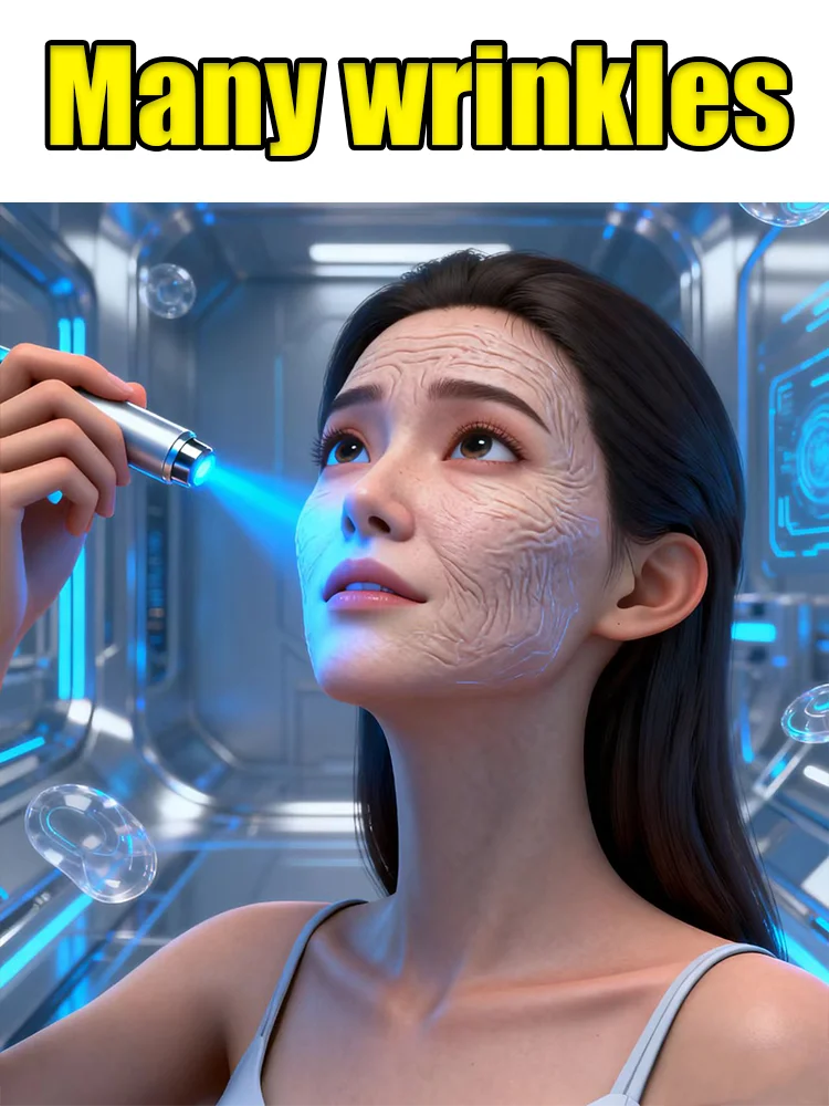 Blue light pen for facial wrinkle repair