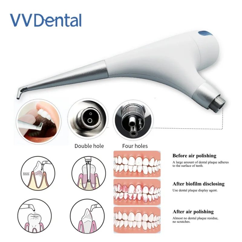 VVDental PV-3 Dental Sandblasting Gun Air Prophy Unit  Anti Suction Hygiene Handheld Polishing Machine Tooth Polishing Tools