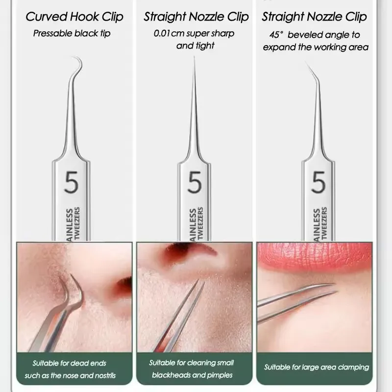 5Pcs Extra Fine No. 5 Cellular Acne Blackhead Tweezers - Facial Beauty Remove Acne Needle Tools for Skin Care