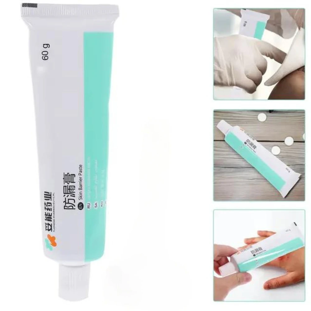 Wholesale Skin Care Powder Stoma Accessories After Surgery Cream Tool Barrier Paste Leak-proof for Ostomy Bag Anti Ointment