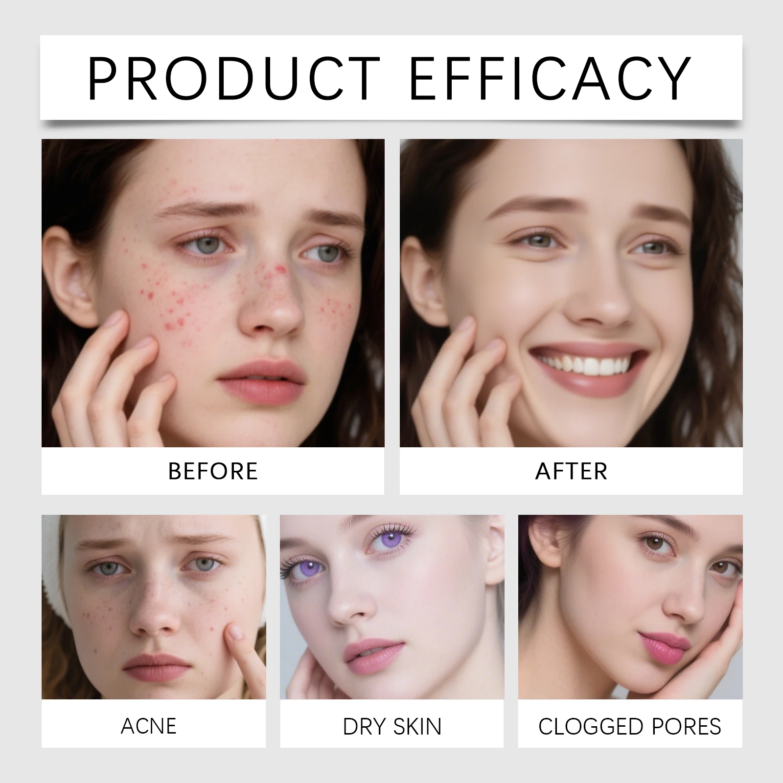 549pcs Hydrocolloid Acne Patch Waterproof Acne Removing Pu Film Face Printing Reduce Redness Skin-Friendly Invisible Acne Patch