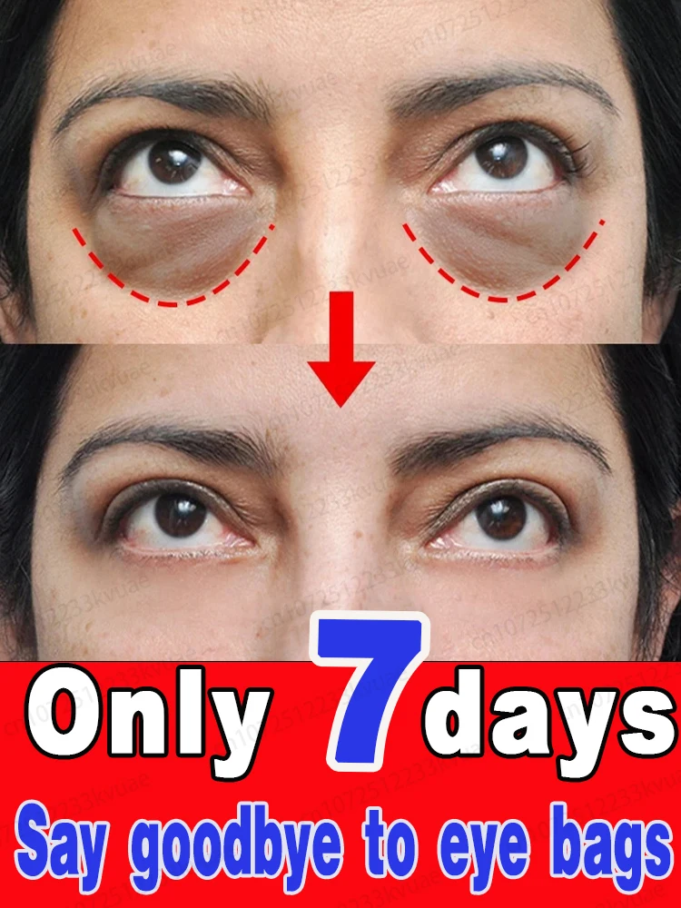 Do you have eye problems such as dark circles, eye bags, etc.? Help you regain your confidence.