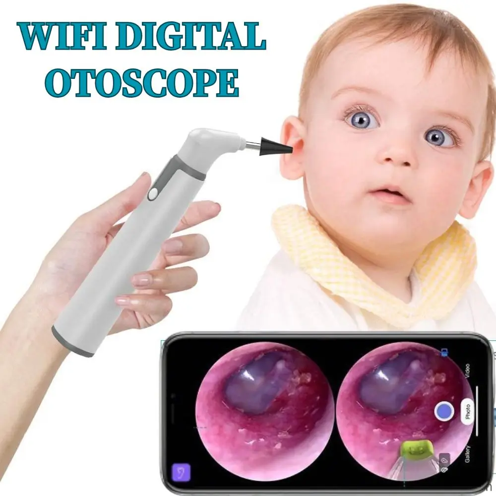 Teslong 3.9mm Ear Otoscope Smart Wireless Portable Endoscope Camera for iPhone Android iPad - Visual Earwax Cleaning Tool