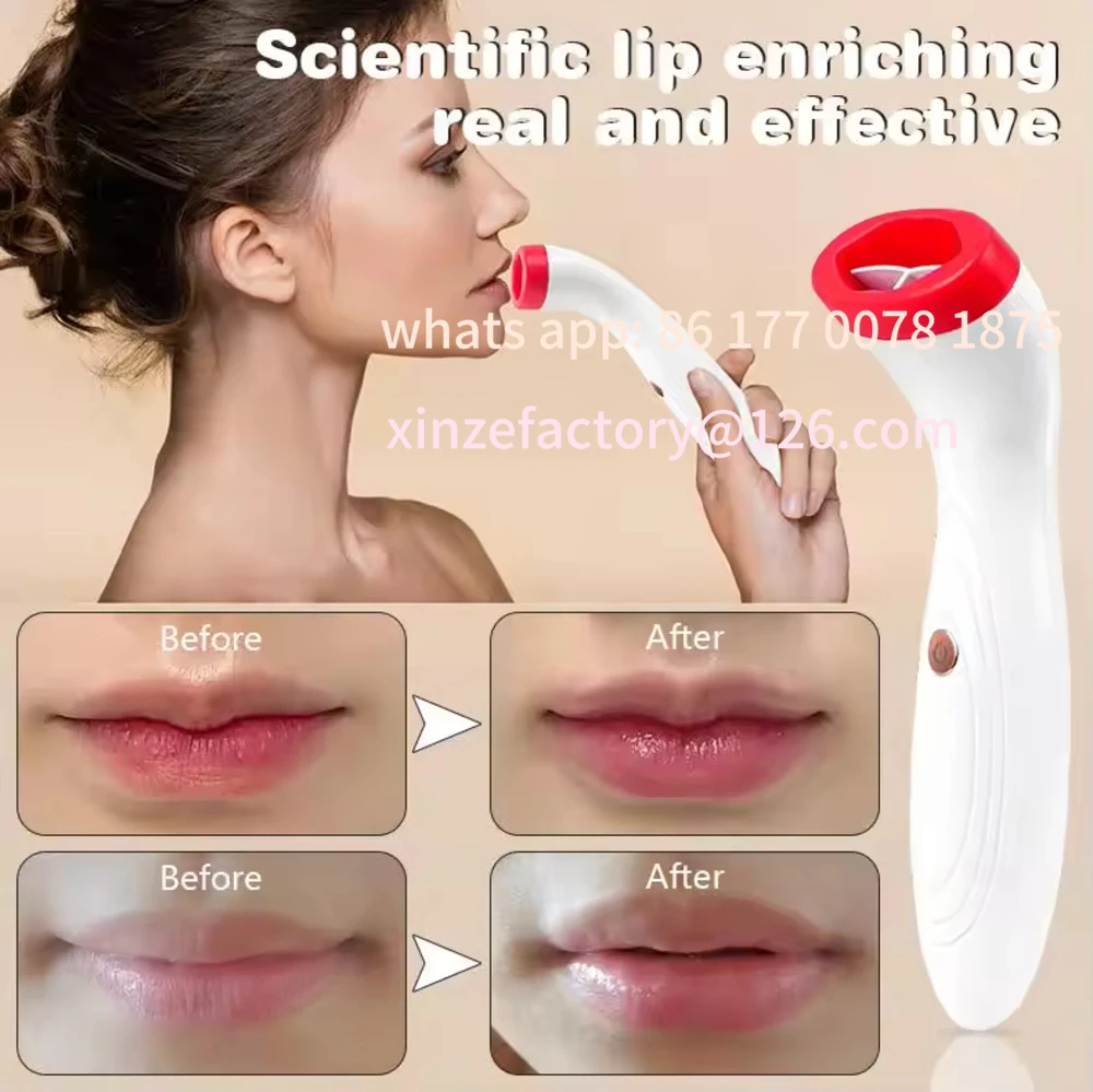 Customizable Silicone Vibrating Lip Care Enhancement Sexy Bigger Electronic Lips Pump Machine Plumper Device Electric Lip Plumpe