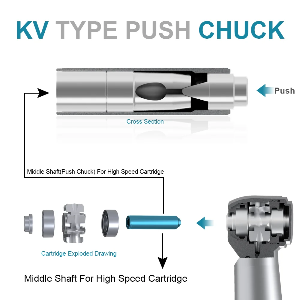 10pcs Dental KV Push Button Shaft Rotor Parts for High Speed Air Turbine Handpiece Parts Repair Tool AI-S-KV