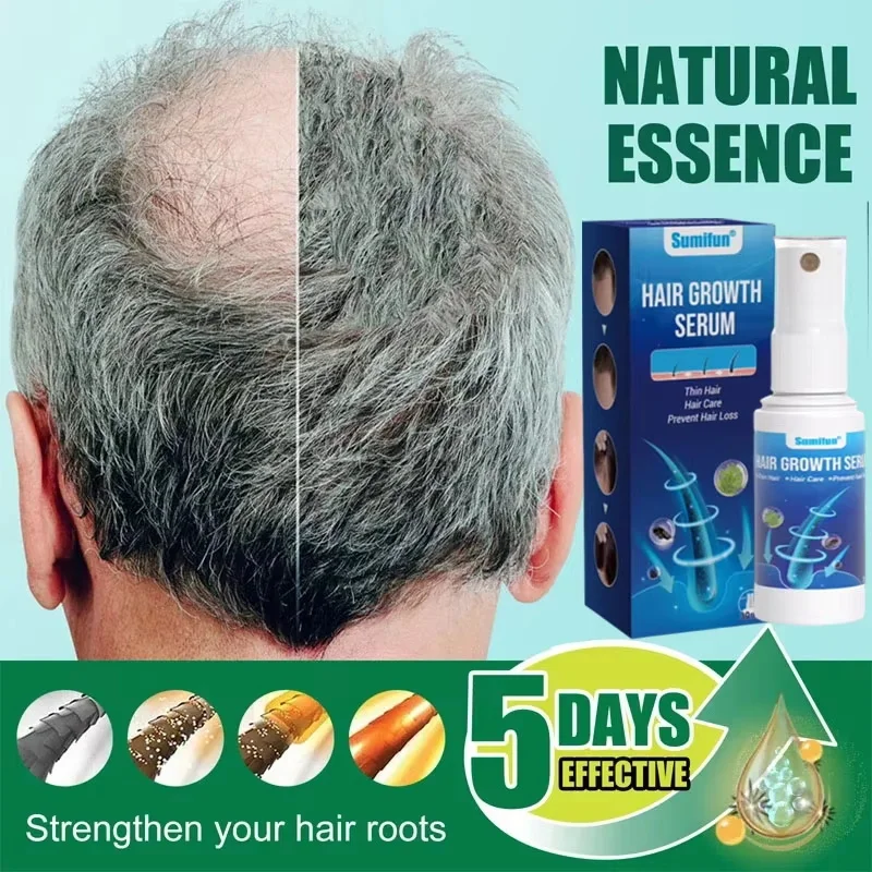 Fast Hair Growth Spray Promote Rapid Hair Growth Hairs Loss Treatment Dense Hair Essence Scalp Loss Repair Nourishing Hairs Care