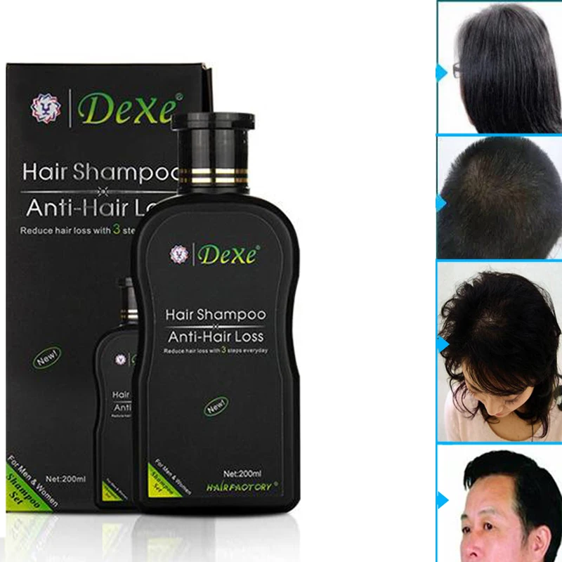 200ml  Hair Shampoo Set Anti-hair Loss Chinese Hair Growth Product Prevent Hair Treatment For Men & Women