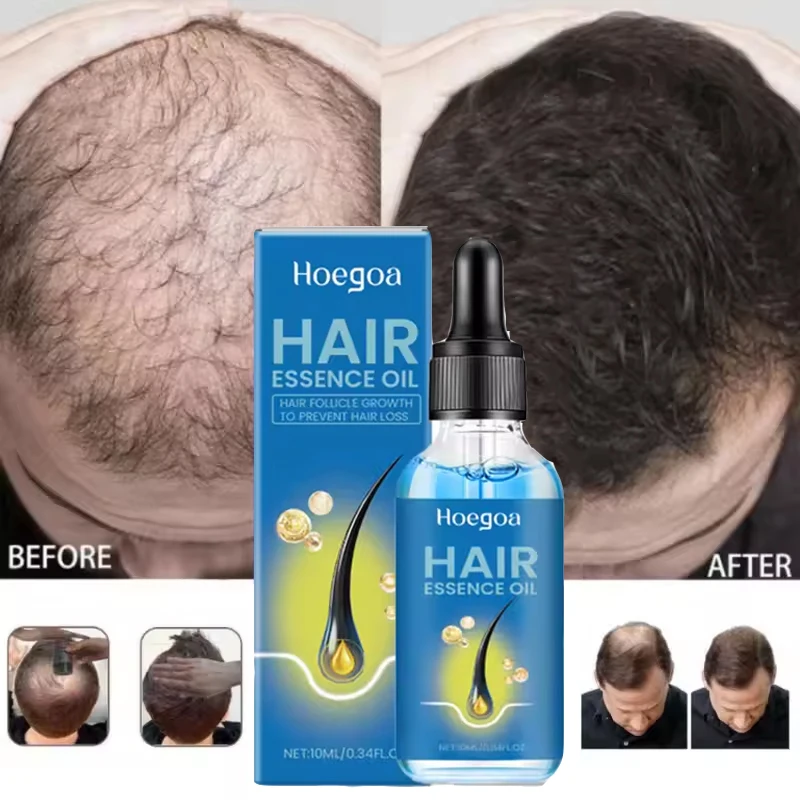 Fast Hair Growth Oil Africa Crazy Traction Alopecia Serum Anti Hair Break Thicken Hair Loss Treatment Serum For Man Women 10ML