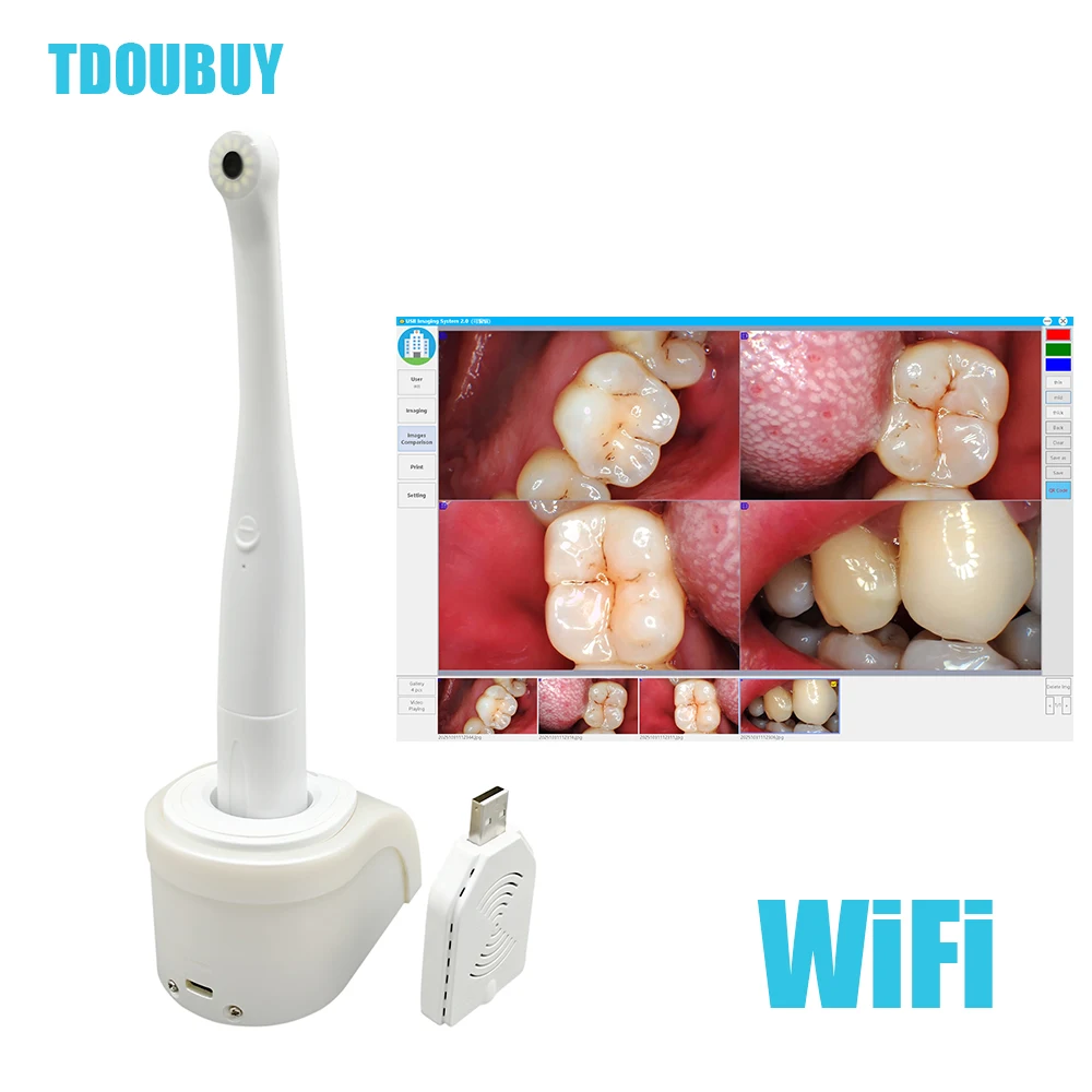 TDOUBUY Denspay Dental Latest Lens Wireless Wifi Intraoral Camera with 1/4 CCD Image Sensor Portable Dental Intraoral Camera
