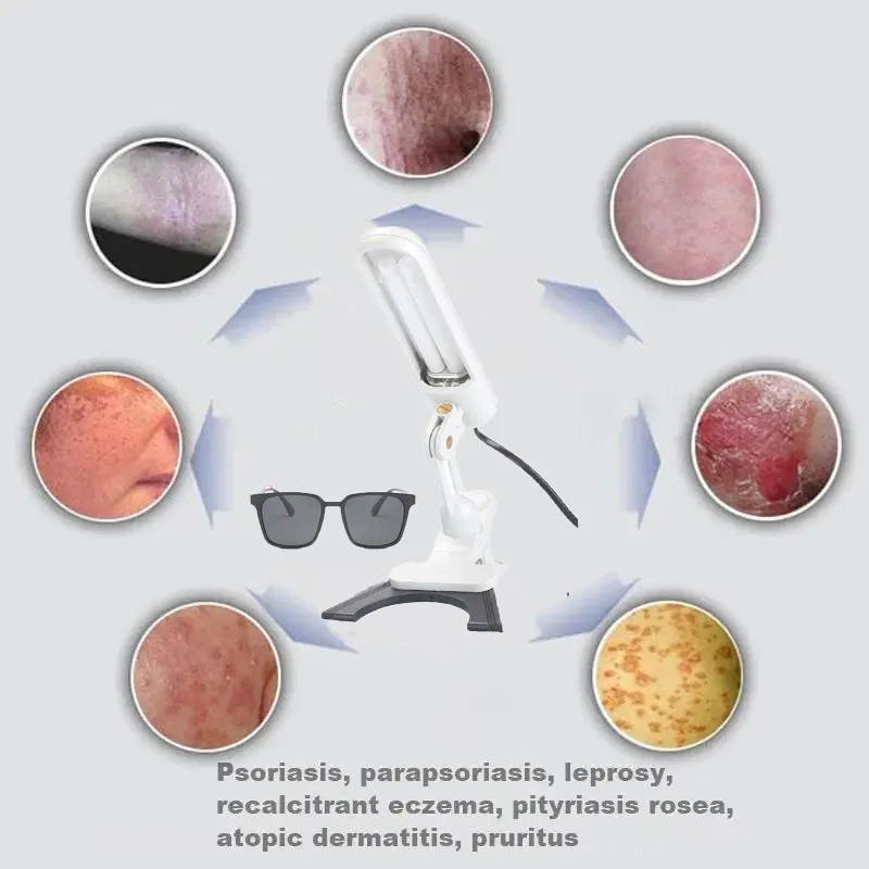 Home use 311NM UVB  Phototherapy instrument For Vitiligo Psoriasis Uses  Lamp Treatment 311nm Psoriasis UV Therapy Device