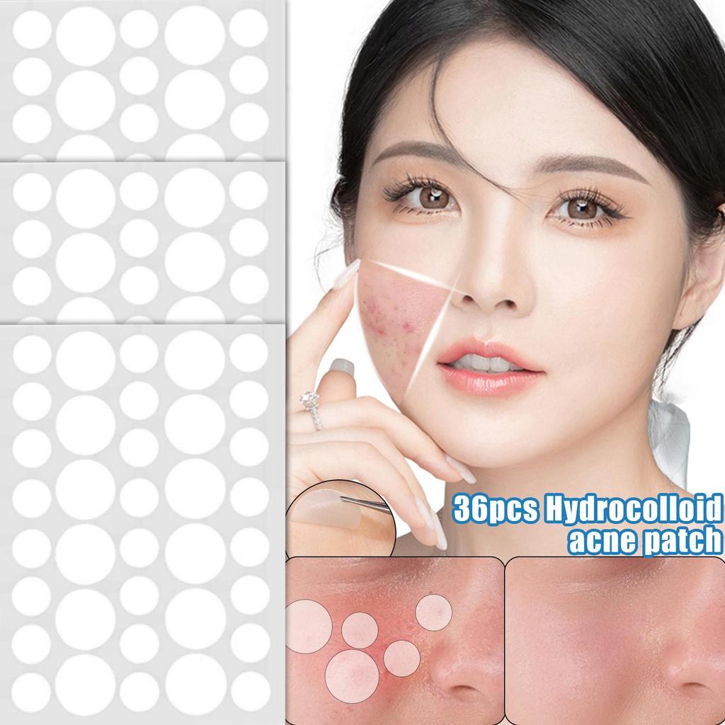 360/720PCS Adesivos Invisíveis Para Espinhas De Acne | Tamanhos Mistos Árvore Do Chá E Hamamélis Ultrafino À Prova D'águ