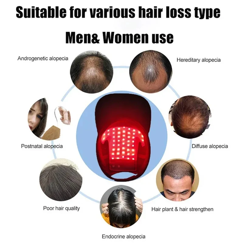 Adjustable Red Near Infrared 660nm 850nm Laser Red Light Therapy Cap Red Light Therapy Hat