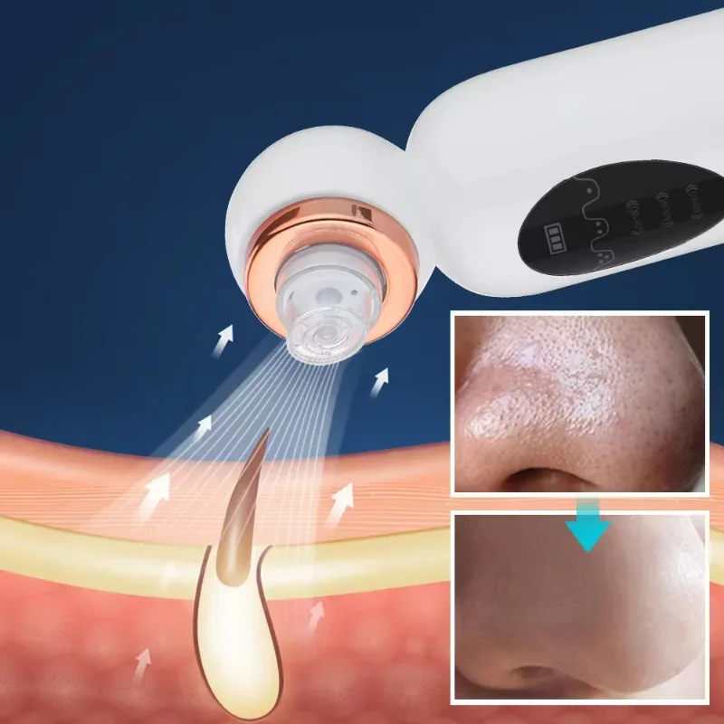New Electri Blackhead Remover Vacuum Bubble Face Nose Cleaner Water Circulation Pore Acne Removal Acne Removal Vacuum