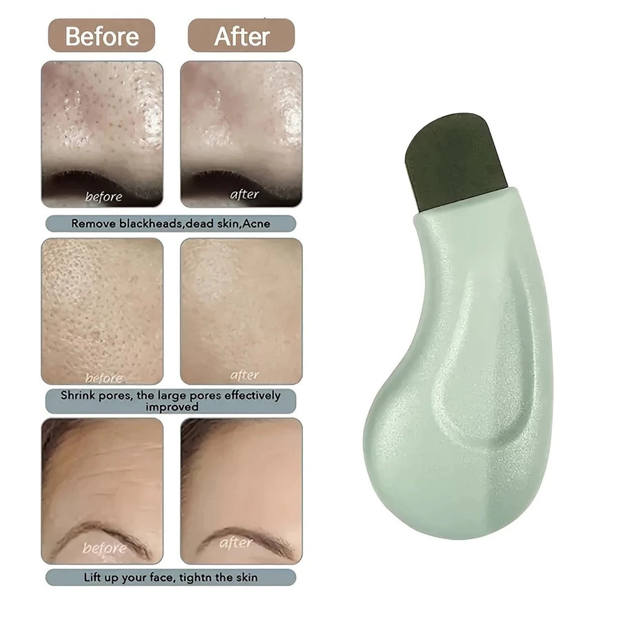 1 Pçs Profissional Nariz Limpeza Profunda Cravo Espinha Ferramenta De Remoção Rosto Esfoliante Espátula Poros Mais Limpo