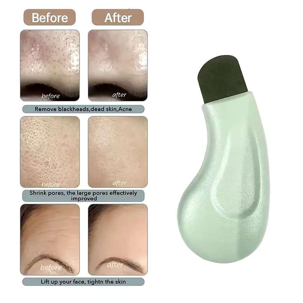 1 Pçs Profissional Nariz Limpeza Profunda Cravo Espinha Ferramenta De Remoção Rosto Esfoliante Espátula Poros Mais Limpo