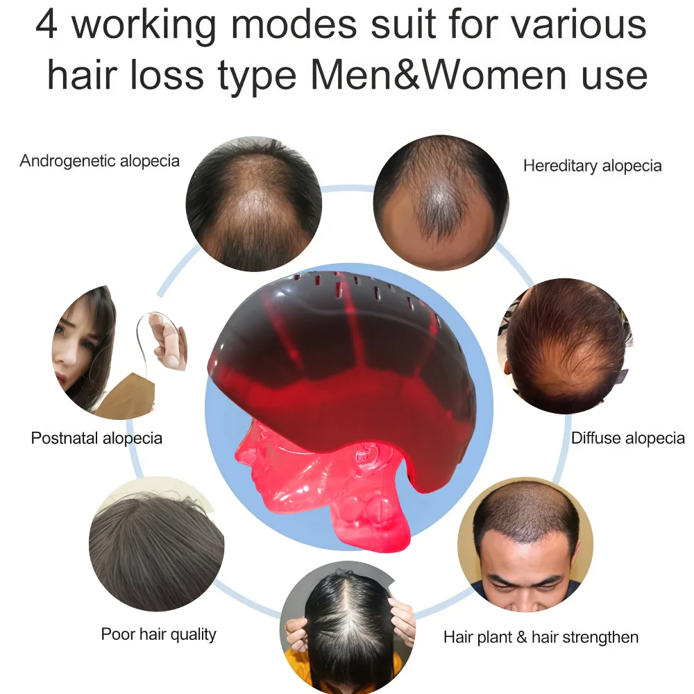 Professional Red Light Hair Growth Helmet, 6750mW 300 Diodes Laser Therapy Cap with 90+210 Lights for Anti Hair Loss