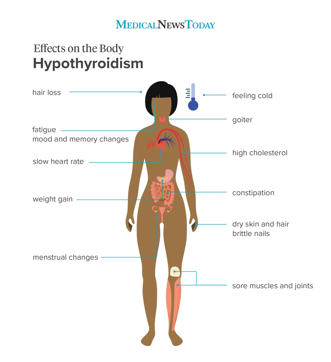Hypothyroidism 1 Cause of Weight Gain