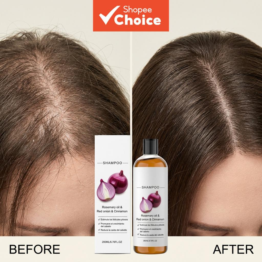 Shampoo de Cebola Vermelha Volumizadora 200 ml com Extrato de Canela – Fórmula Leve para Cabelos Mais Fortes e