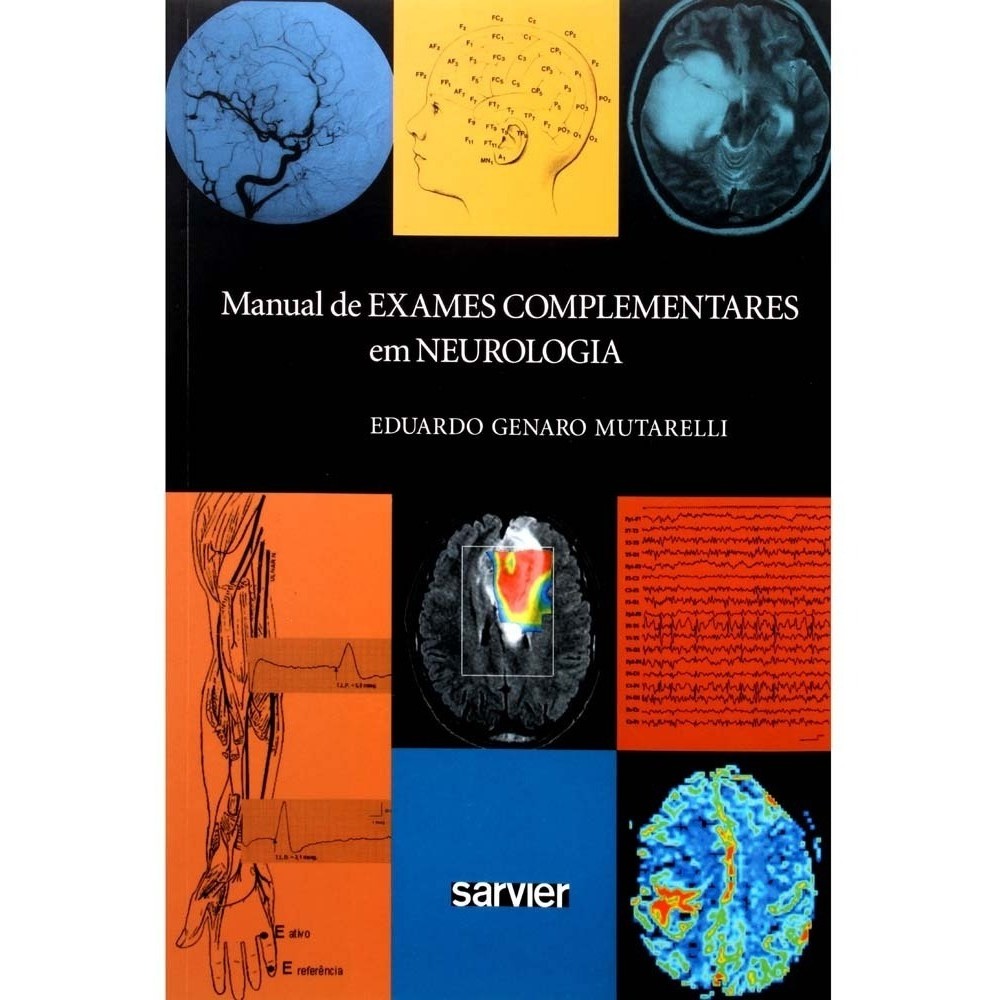 Livro - Manual De Exames Complementares Em Neurologia - Muta