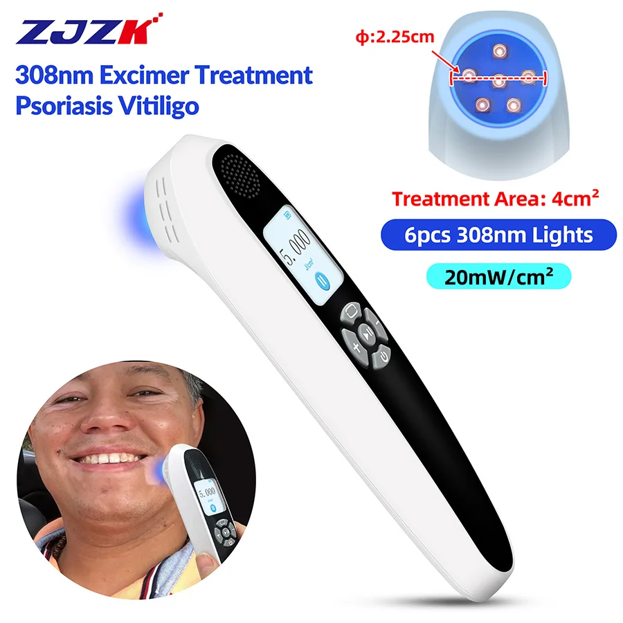 2026 LCD Display 308nm UVB Phototherapy 6 Diodes Portable Vitiligo Psoriasis Therapy 20mW/cm2 0-180s Timer 4cm² Treatment Spot
