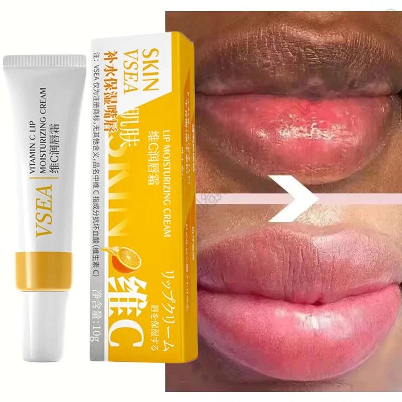 Fast Lightening Pink Mouth Lips Serum Bleaching Permanent Remove Dark Smoke Lips Lip Balm Moisturize Gloss Lipstick Lip Serum