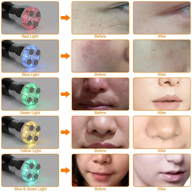 Face Massage Roller Led Light Photon Facial Mesotherapy Electroporation Face Lift Roller Beauty Machine for Skin Tightening