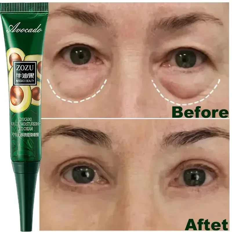 Abacate Tighten Wrinkles Eye Cream Anti Dark Circles Bags Puffiness Fade Fine Line Whiten Under Eyes Skin Cuidados Com A Pele Coreana , Extrato De Essência Creme Hidratante Elástico Para Os Olhos