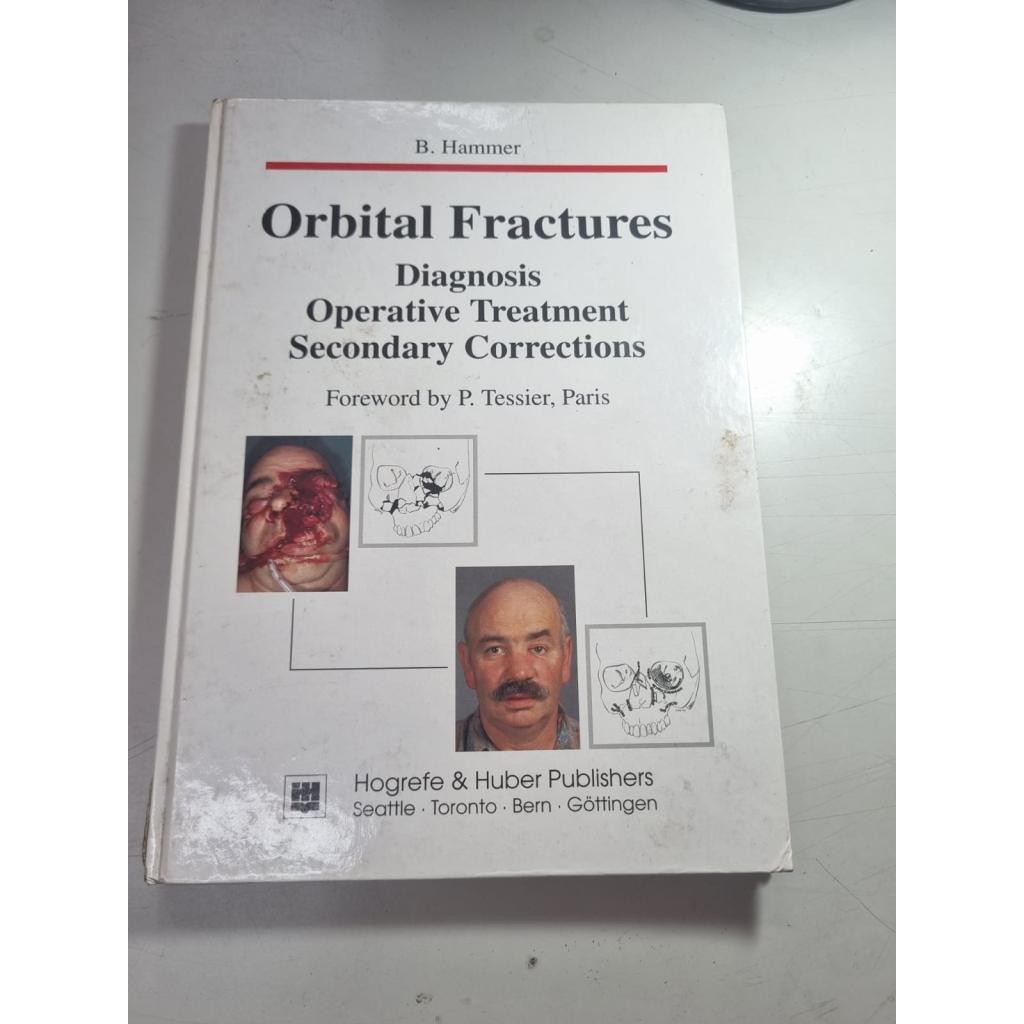 Orbital Fractures Diagnosis Operative Treatment Secondary Corrections