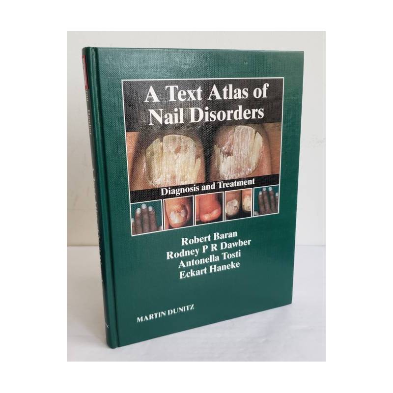 A Text Atlas Of Nail Disorders: Diagnosis And Treatment autor Robert Baran e Outros
