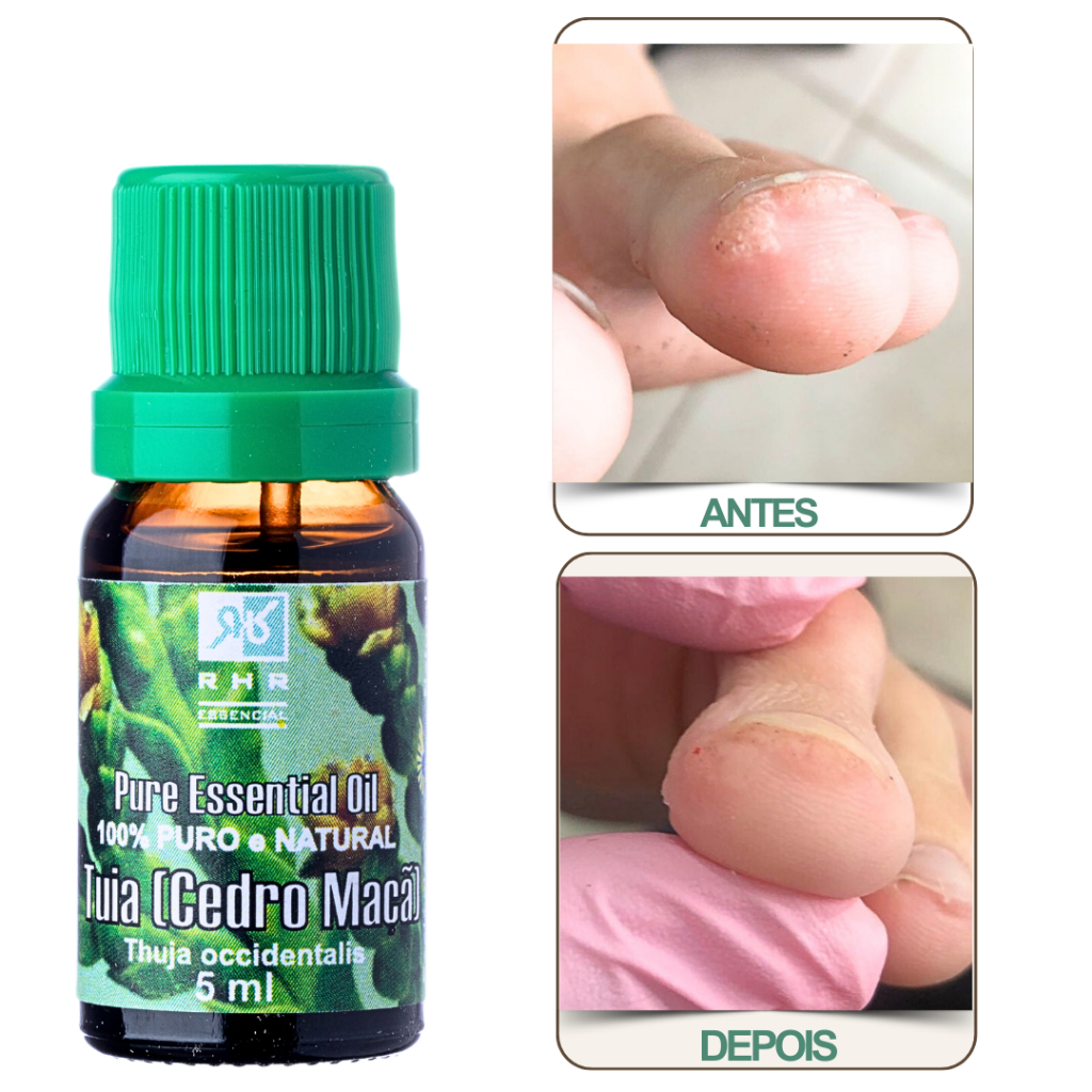 Óleo Essencial De Tuia (cedro Maça) 5ml - 100% Puro